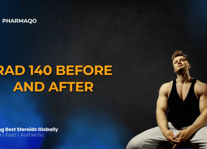 Rad 140 Before After